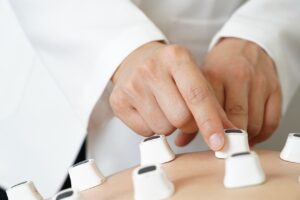 シミを自宅で治療するためのレーザーの効果は？